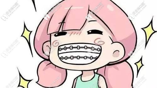 牙齒矯正戴牙套會(huì)損傷牙釉質(zhì)嗎