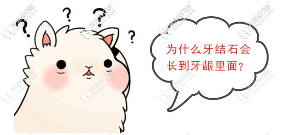 為什么牙結(jié)石會長到牙齦里面？