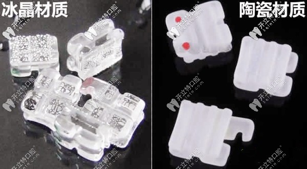冰晶牙套矯正的價(jià)格