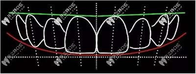 DSD美學(xué)修復(fù)