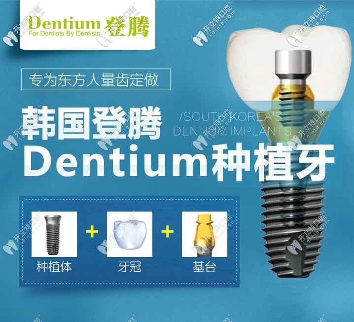 南京做韓國登騰種植牙多少錢？它的使用壽命有多長呢？