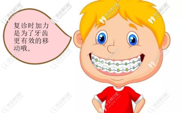 復(fù)診時加力更換弓絲