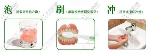 活動(dòng)假牙的清潔方法