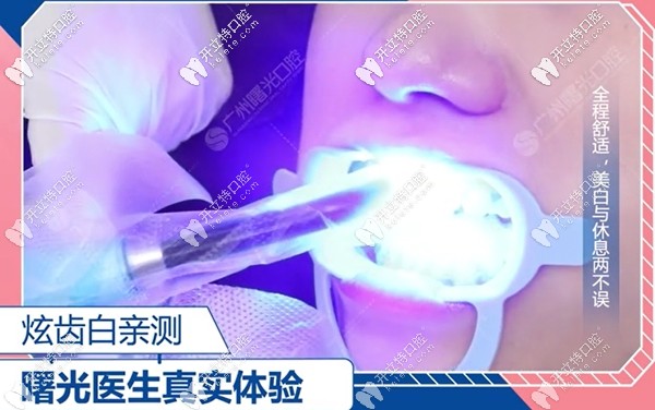 曙光口腔正畸科李醫(yī)生親測(cè)炫齒白的過(guò)程