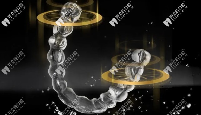 想知道國產(chǎn)隱形牙套—正雅悅享版價(jià)格的，請(qǐng)舉手！