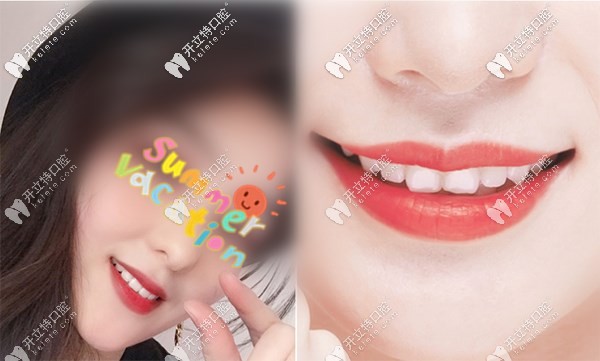 七夕格倫菲爾口腔活動