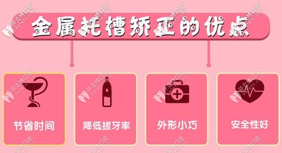 固定鋼絲牙套的優(yōu)點