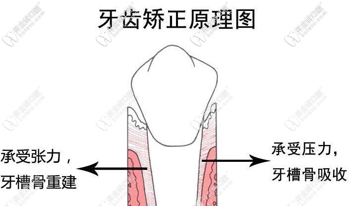 牙齒移動的過程