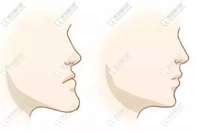 長沙地包天矯正做的好的醫(yī)院名單，兒童成人都有