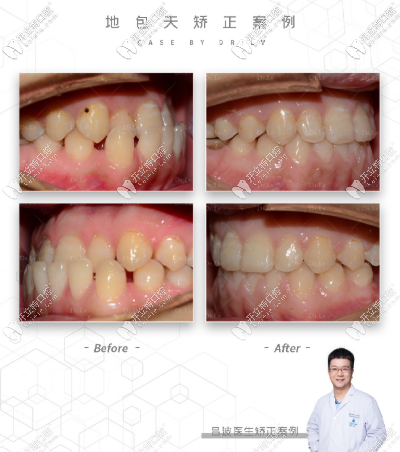 長沙牙祖口腔呂波醫(yī)生案例