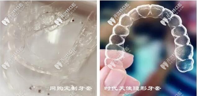 隱形牙套戴了一年沒效果變化?你不會是網(wǎng)購的牙套吧