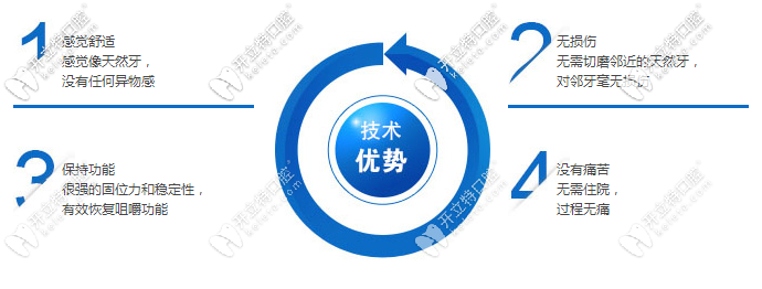 nobelcc種植牙優(yōu)勢