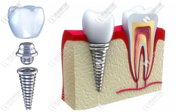 劉洪飛主任的擅長(zhǎng)領(lǐng)域介紹
