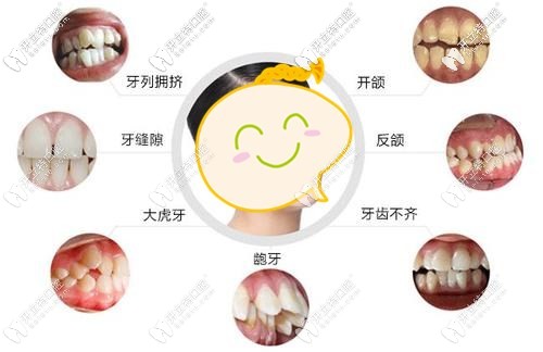 廣州廣大口腔牙齒矯正活動(dòng)價(jià)