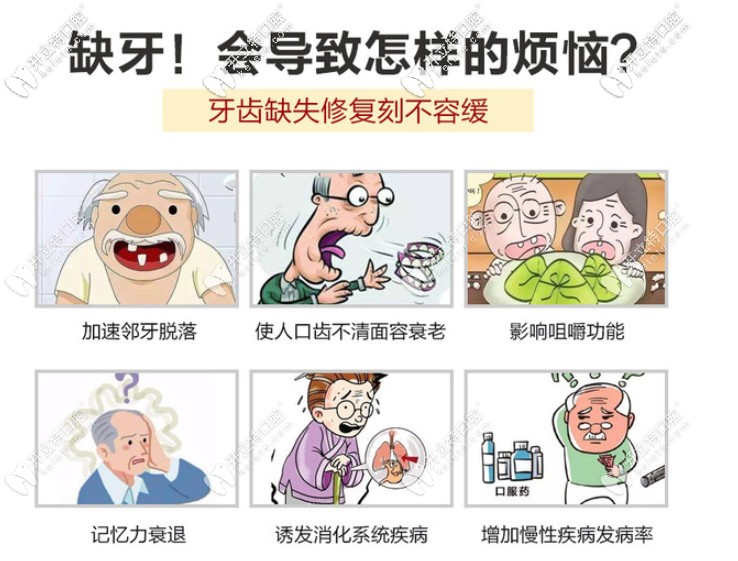 9月種植牙優(yōu)惠價格表