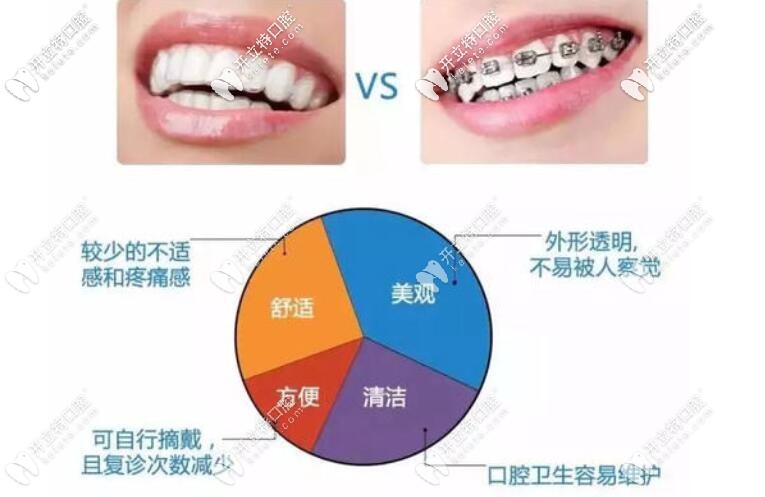 金屬牙套和隱形牙套哪個好