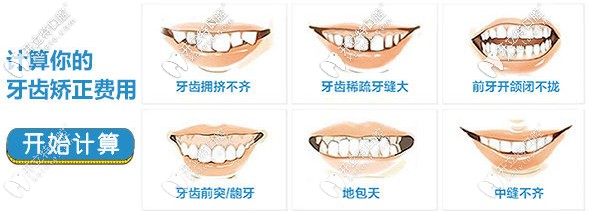 搜集到一份信陽伢牙齒科做牙齒矯正的價格表前來分享