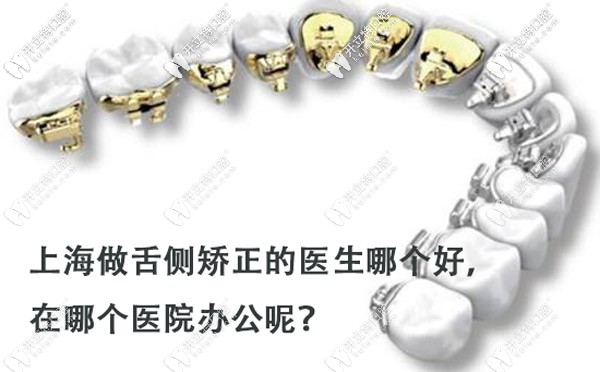 上海做舌側正畸的醫(yī)生哪個好？打算戴ebrace隱形牙套