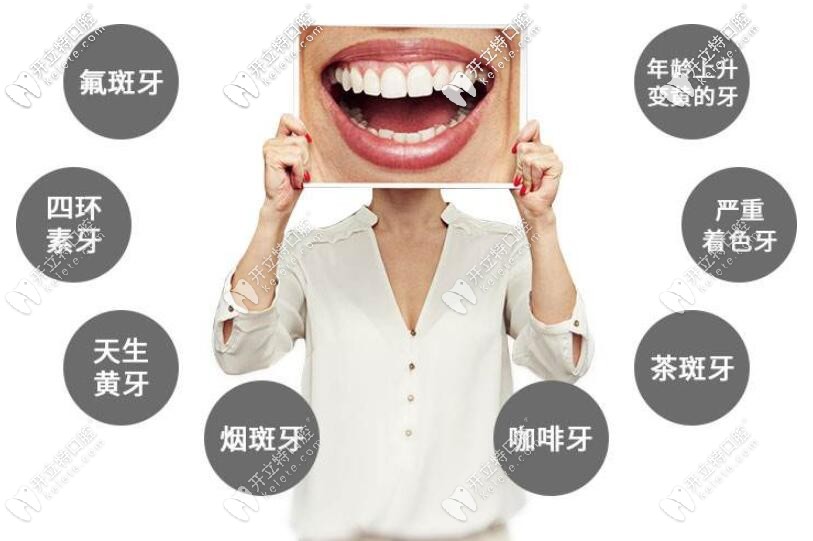 前牙美學(xué)修復(fù)適應(yīng)癥 前牙美學(xué)修復(fù)適應(yīng)癥