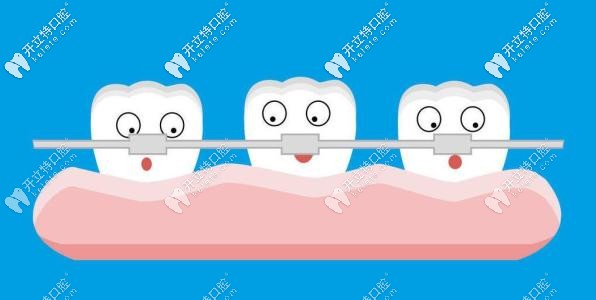 牙齒矯正是不可逆的