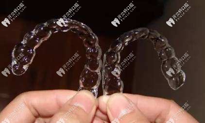 隱形牙套外觀 隱形牙套外觀