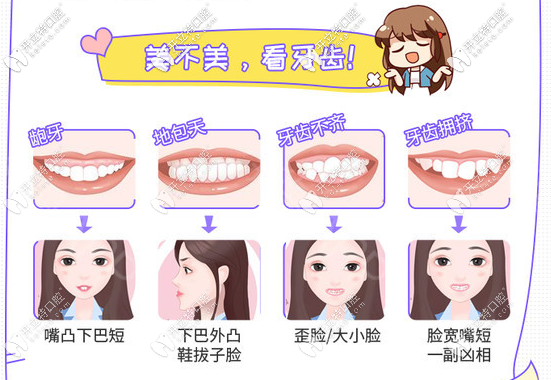 牙齒正畸適應(yīng)癥