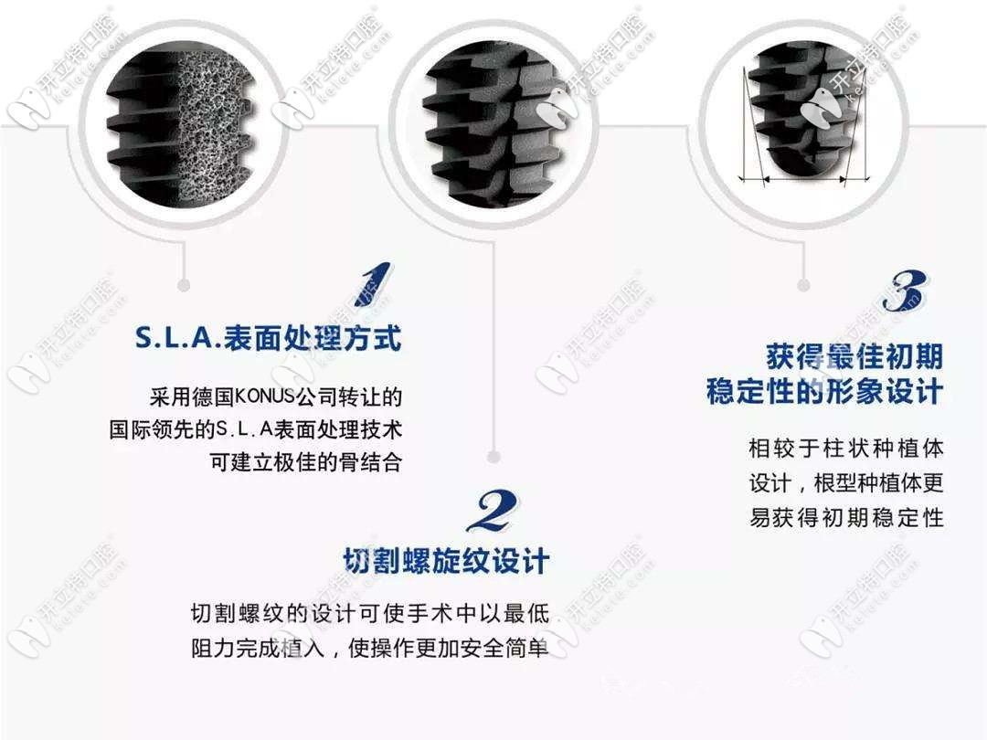 韓國(guó)仕諾康種植牙的優(yōu)勢(shì)
