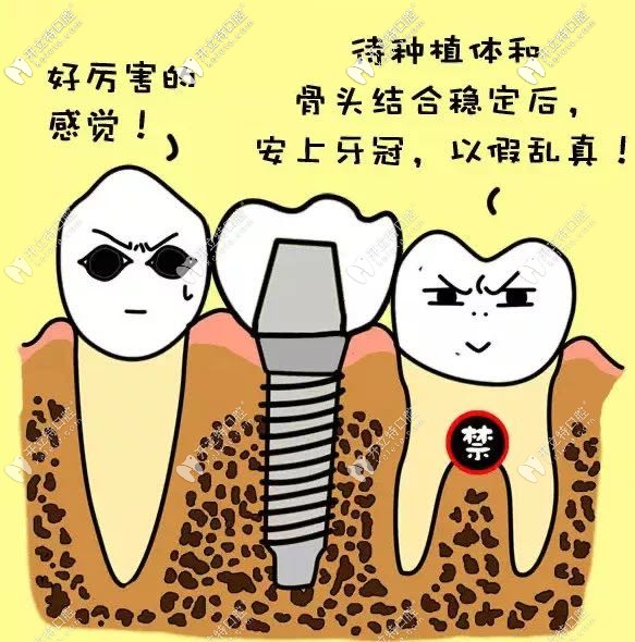 石家莊中諾口腔種植牙價格表(2974-6794元起)二級醫(yī)院|技術好