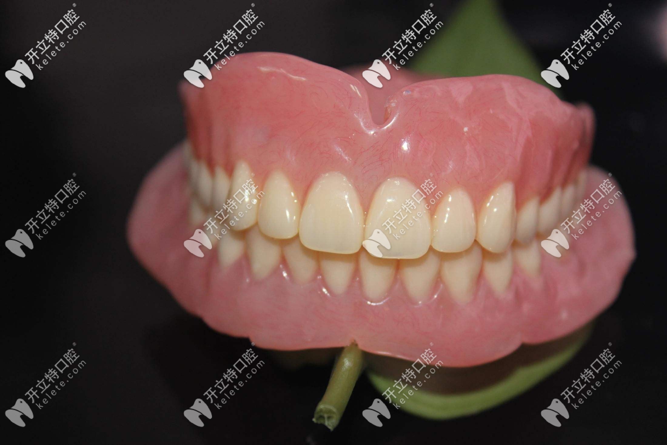 全口吸附性義齒圖片