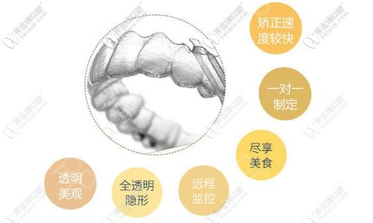 正雅隱形矯正 特點(diǎn)