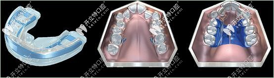 MRC外觀(guān)及佩戴 MRC外觀(guān)及佩戴