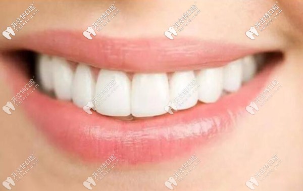 前牙種植 前牙種植