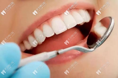  重慶做牙貼面多少錢一顆?不妨看看美奧口腔牙齒美白價(jià)格表