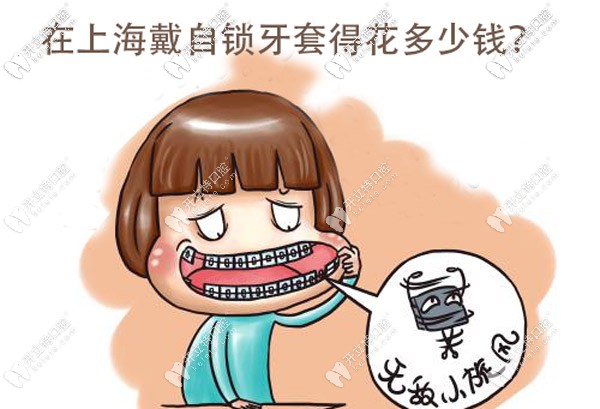 目前在上海戴金屬自鎖牙套的價格大概是多少？