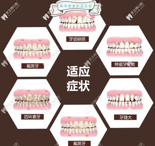 尤樂平醫(yī)生的擅長項目介紹