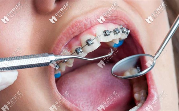 趙郡凡醫(yī)生的擅長(zhǎng)項(xiàng)目介紹