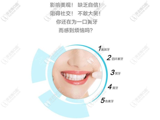 牙齒美白 牙齒美白