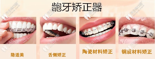 深圳齙牙矯正器