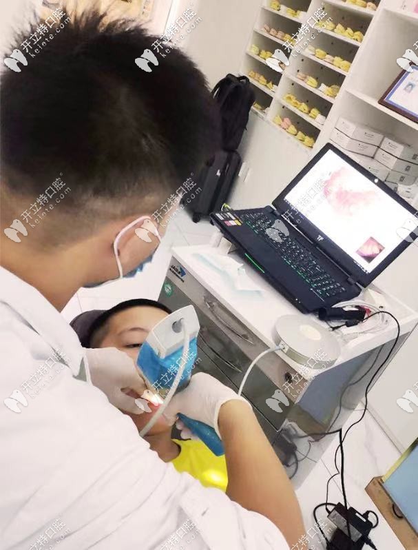 itero口掃儀 itero口掃儀