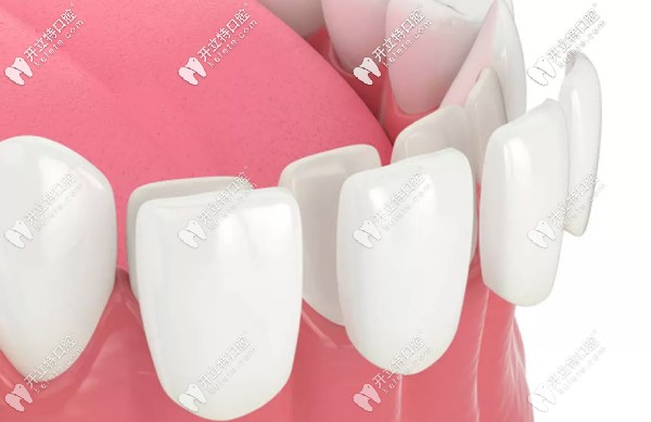 耐磨損的性能更高