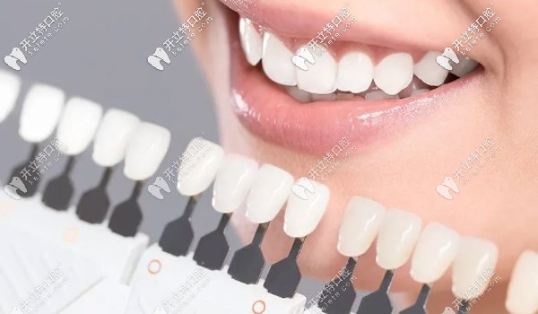 貼面不易導(dǎo)致牙齒變色