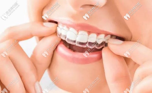 聽說國外建議戴著隱形牙套吃東西,那不會磨損矯正器嗎？