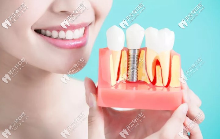 拔完牙一年后還可以做種植牙嗎