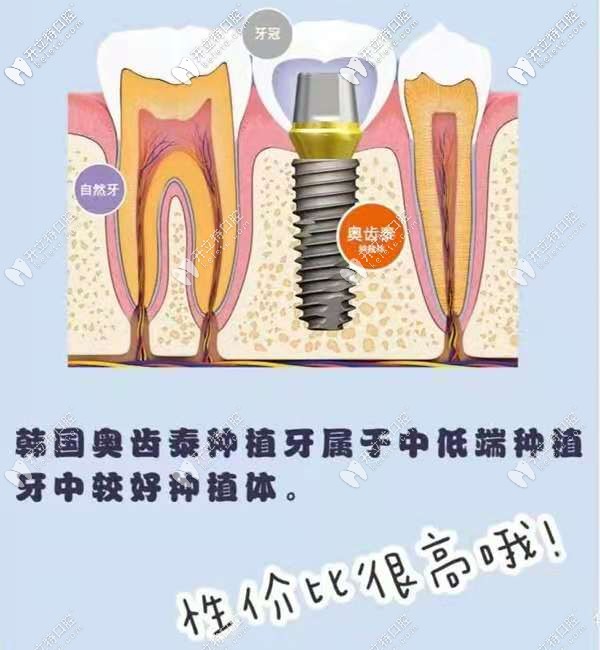 長(zhǎng)沙韓德口腔做韓國(guó)奧齒泰優(yōu)惠