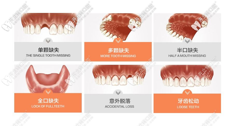 種植牙適應(yīng)癥