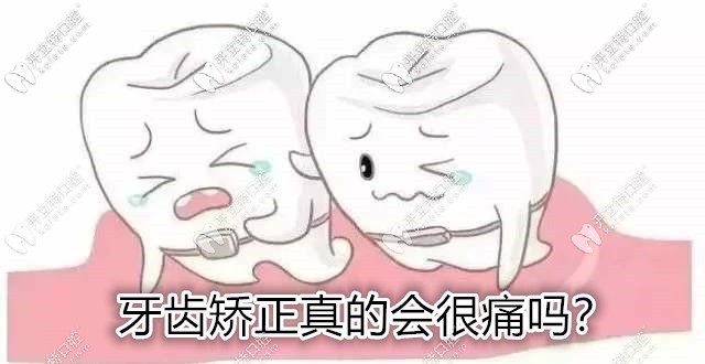 你知道矯正牙齒的痛算幾級疼痛嗎?來看看整牙哪步較疼吧！