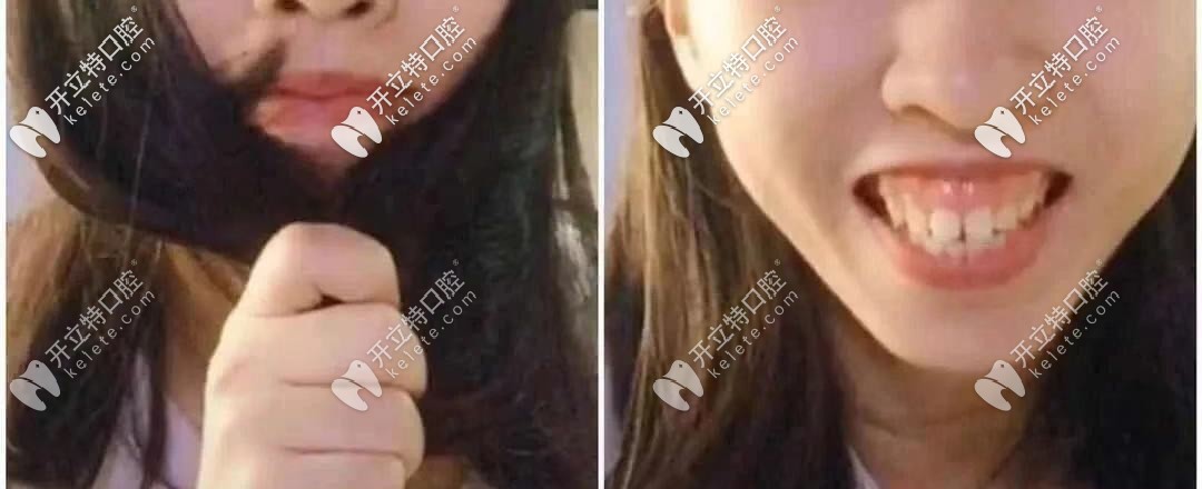 顏值是否也被封??？