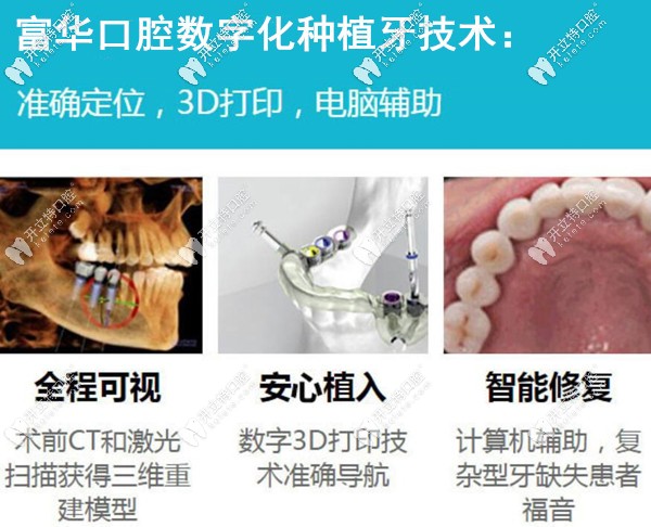 深圳富華口腔數(shù)字化種植牙技術(shù)