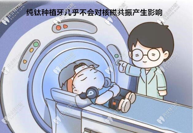 種植牙幾乎不會對核磁共振產生影響