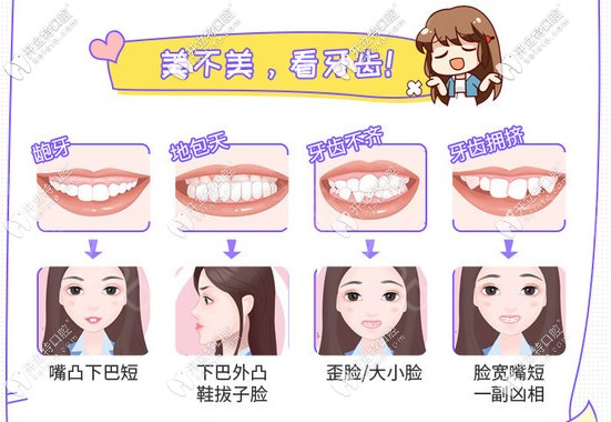 平江致遠(yuǎn)口腔的牙齒矯正適應(yīng)癥狀